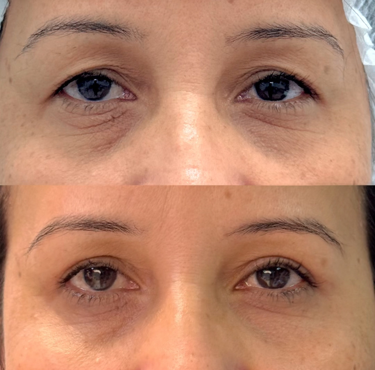Antes e depois 1