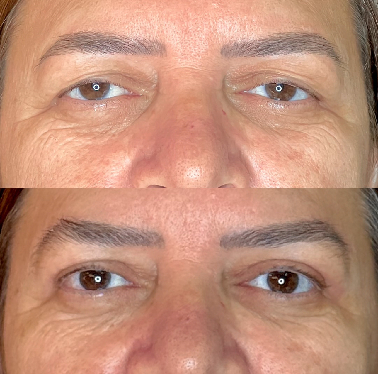 Antes e depois 2