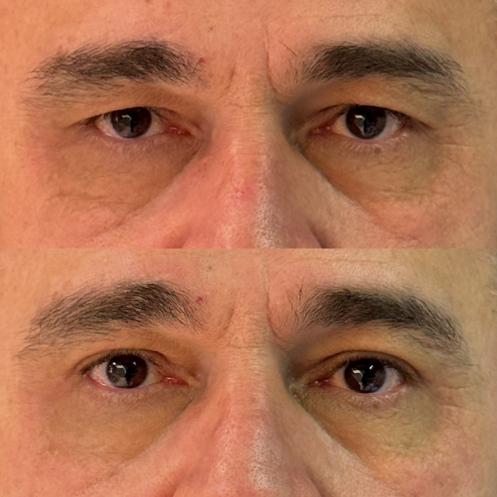 Antes e depois 3