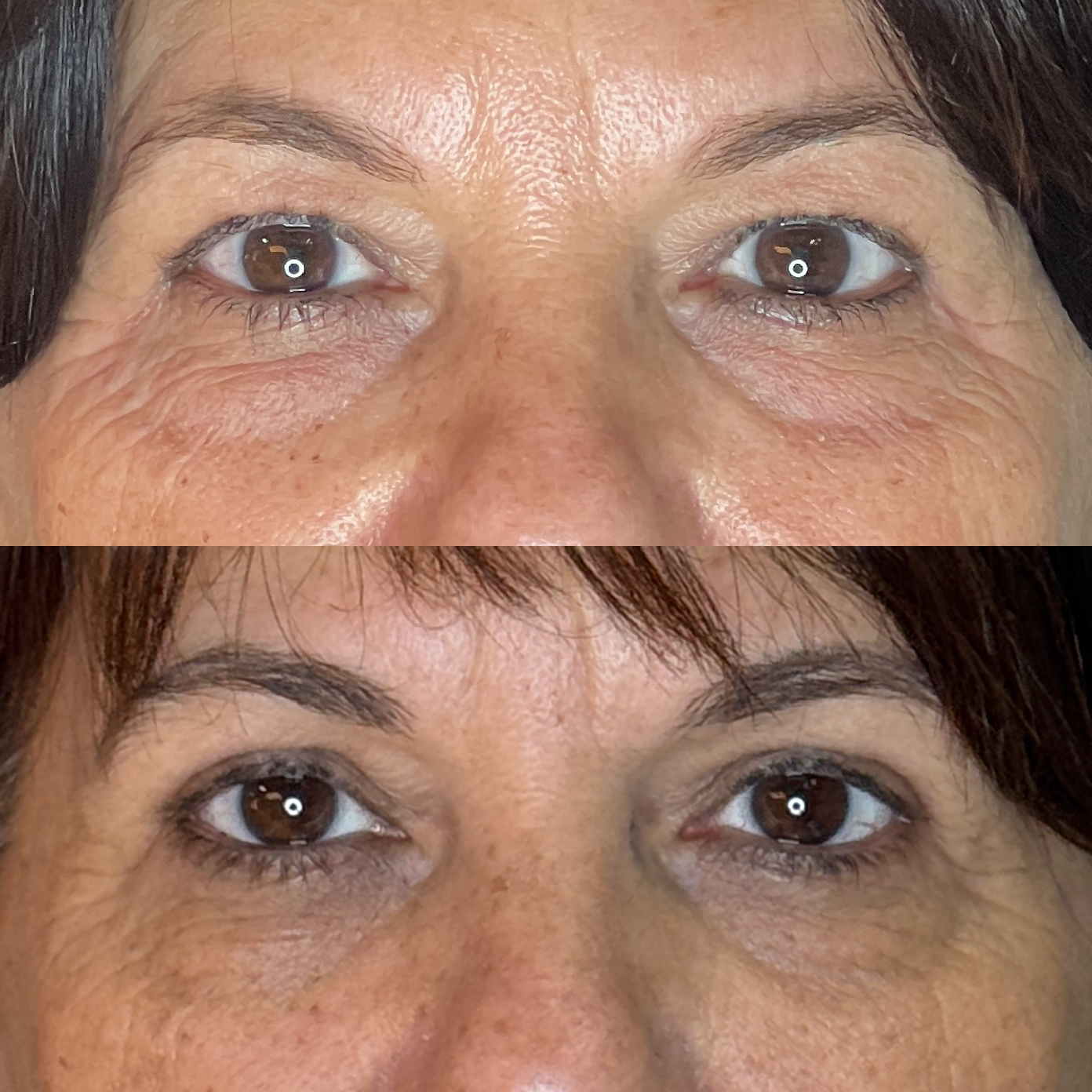 Antes e depois 5
