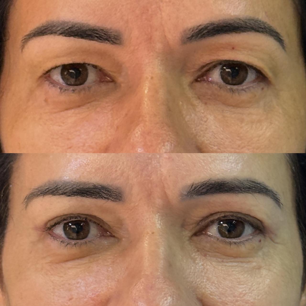 Antes e depois 12