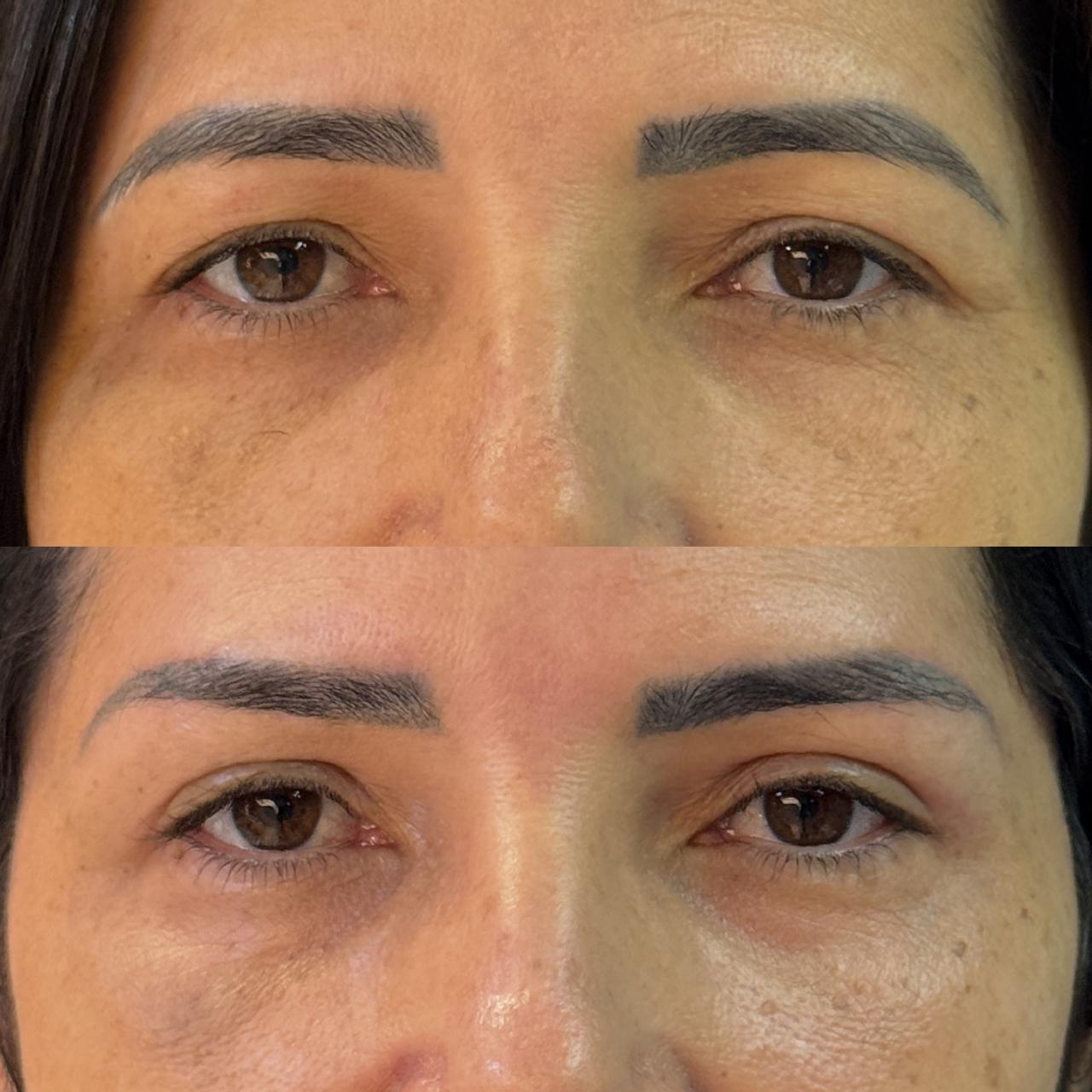 Antes e depois 13