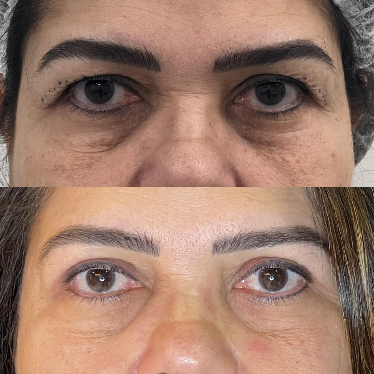 Antes e depois 14