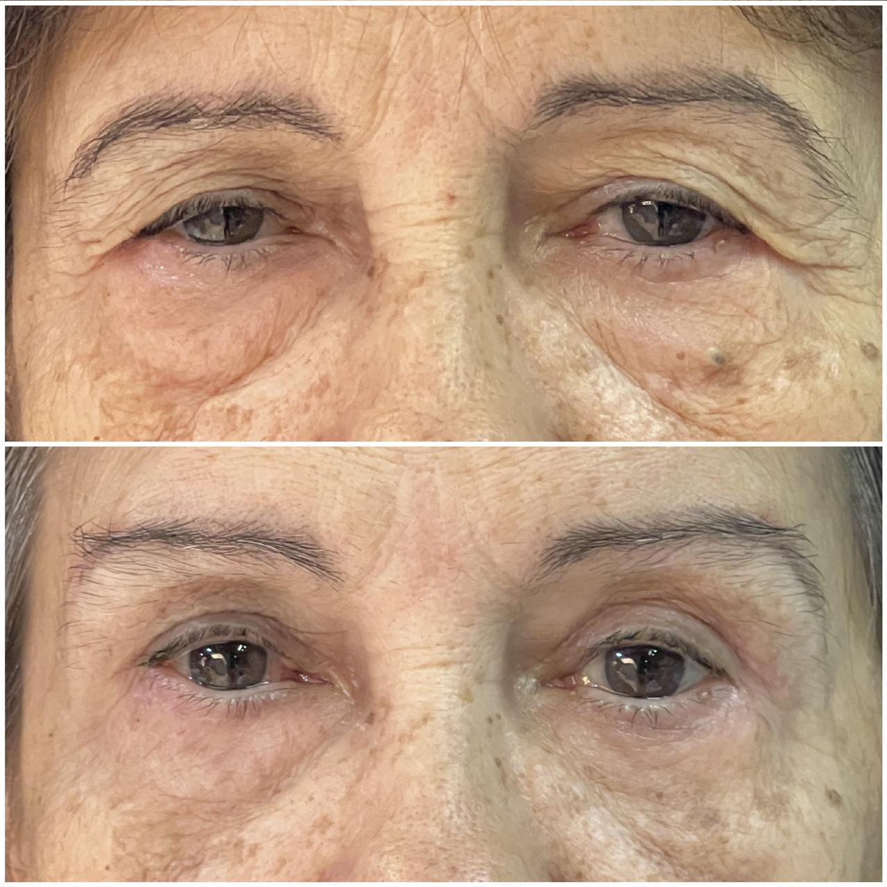 Antes e depois 2
