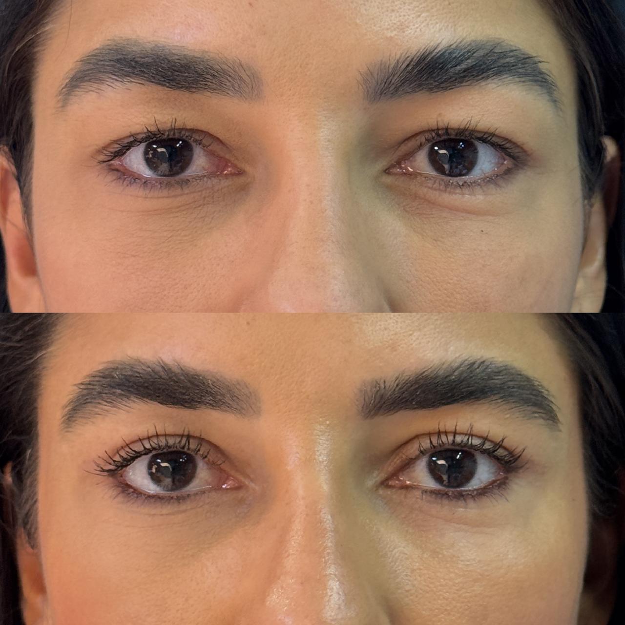 Antes e depois 3
