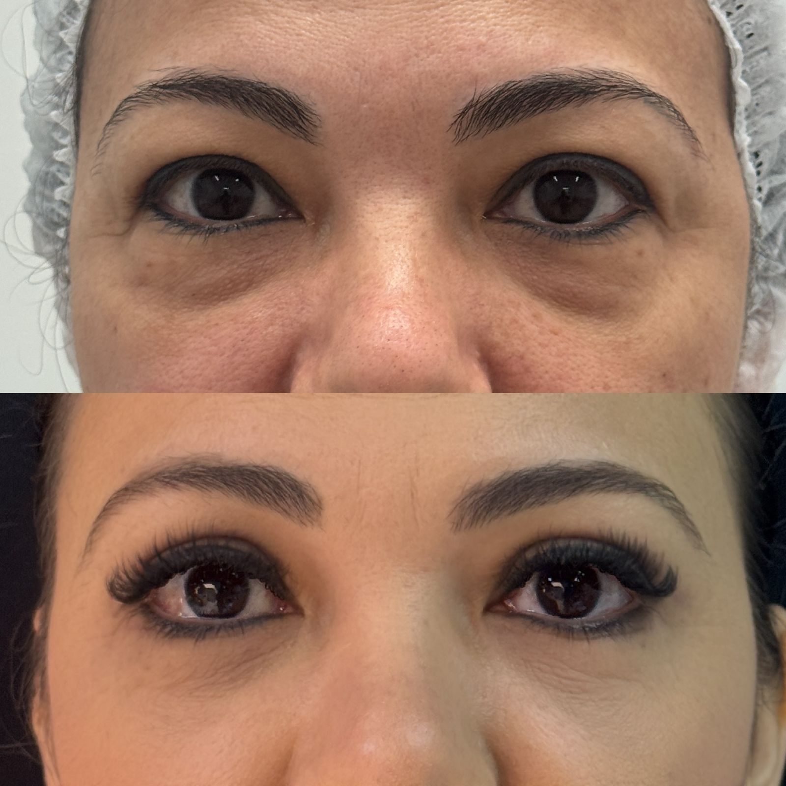 Antes e depois 4