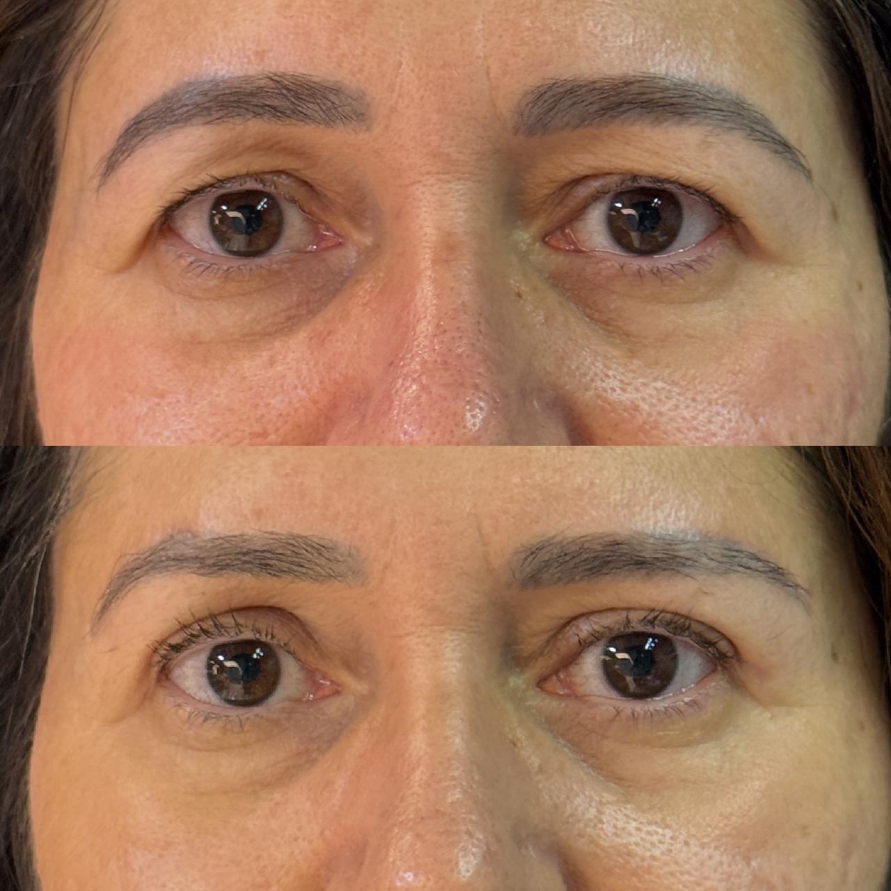 Antes e depois 5