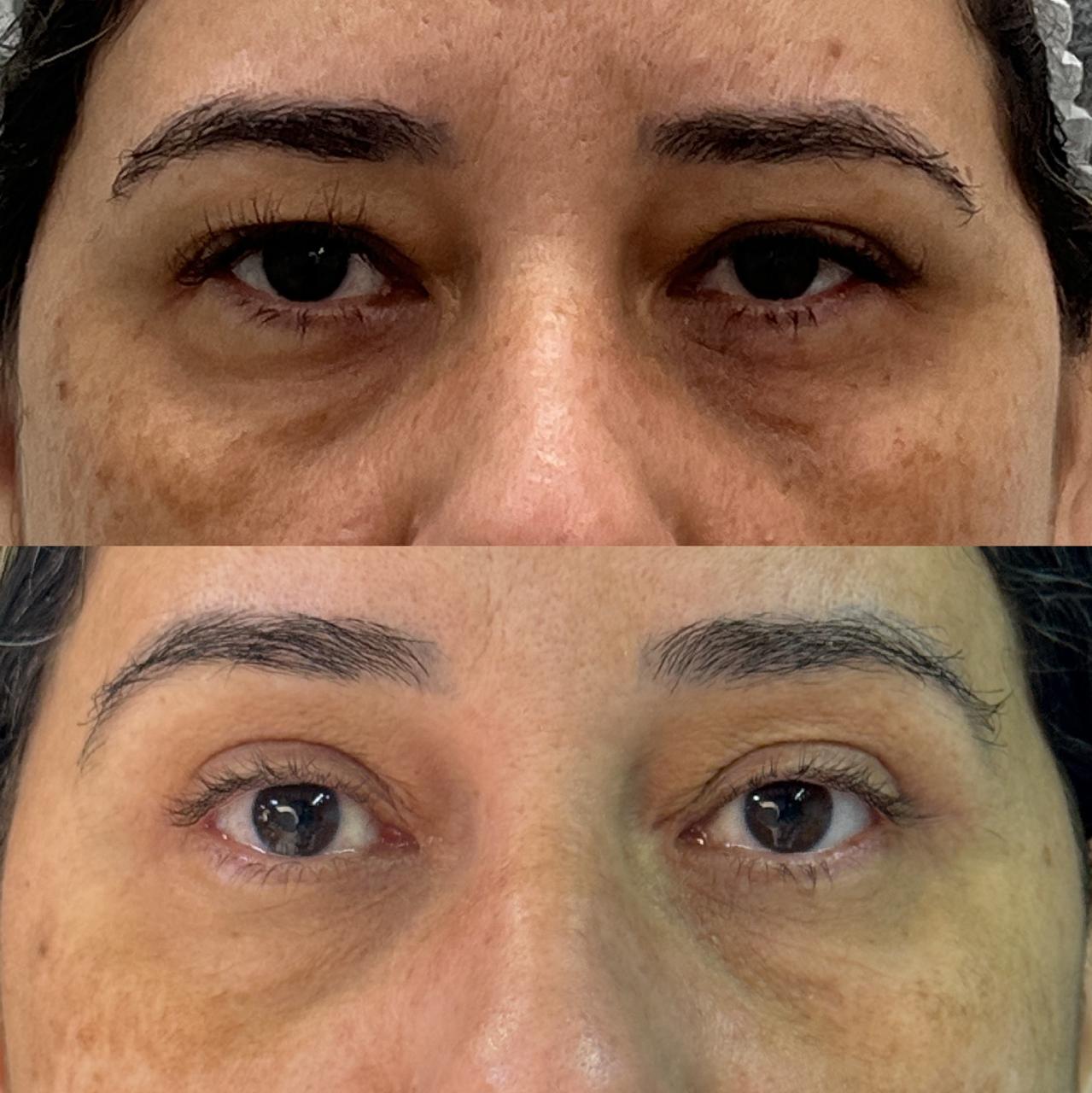 Antes e depois 6