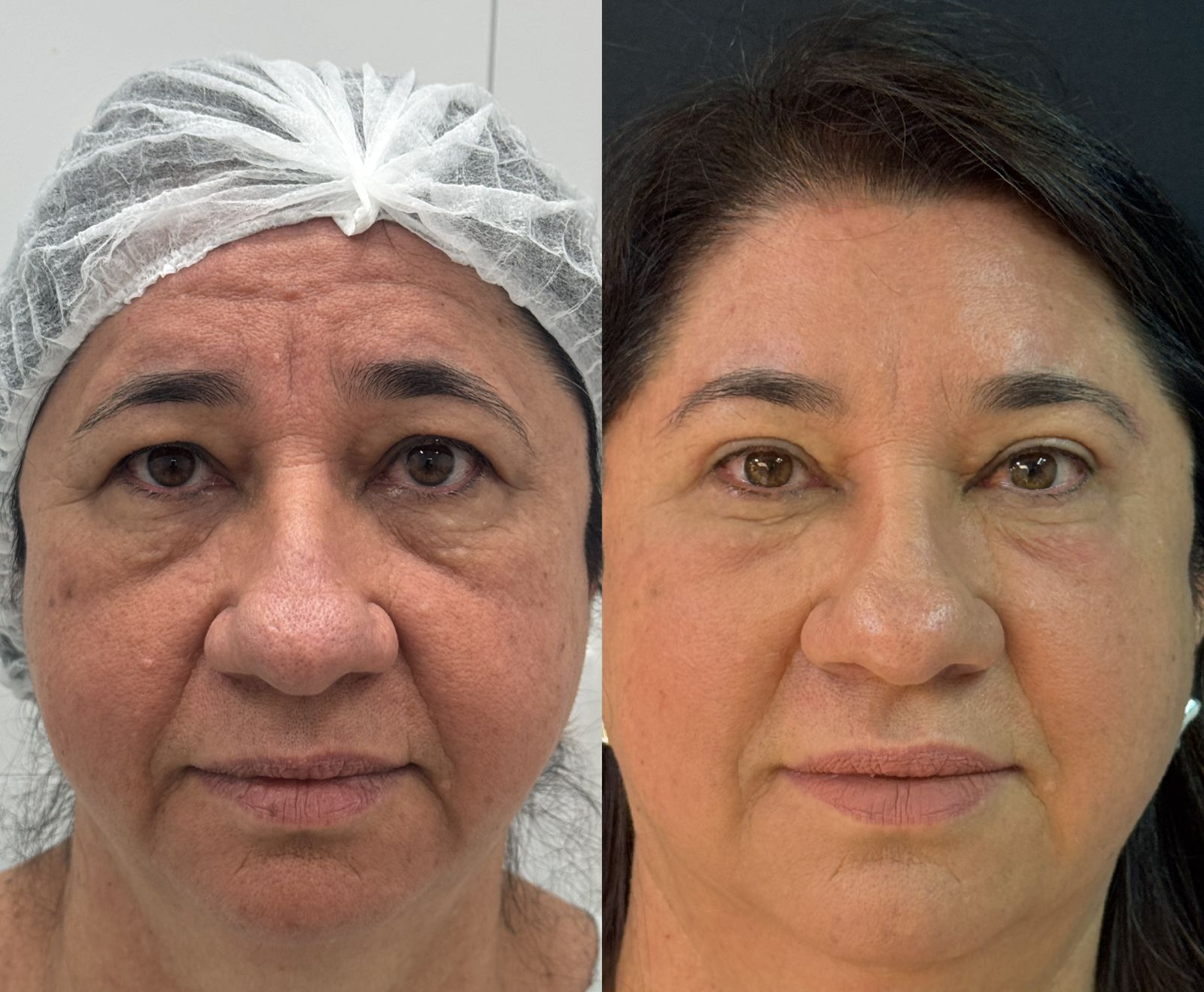 Antes e depois 7