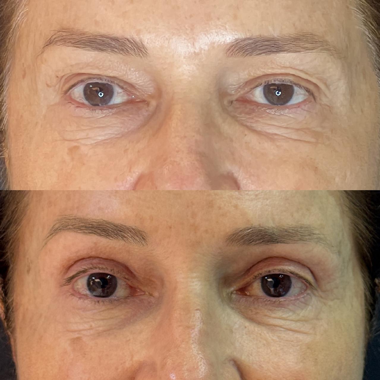 Antes e depois 8
